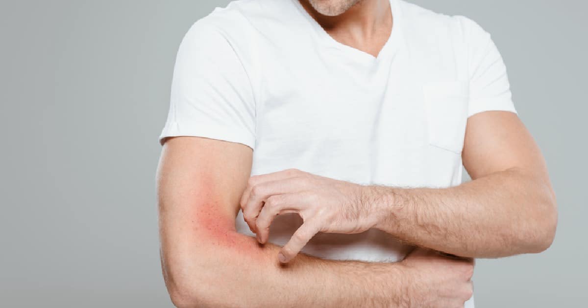 Man itching his arm due to neuropathic itch