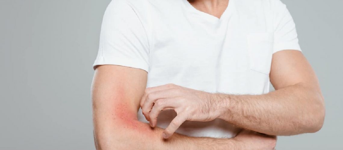 Man itching his arm due to neuropathic itch